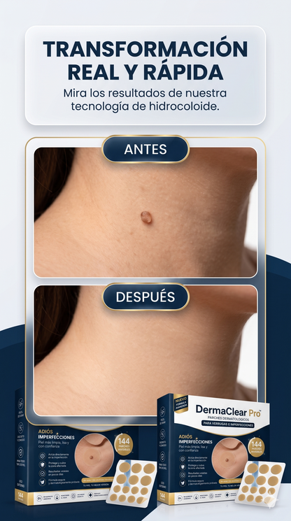 DermaClear Pro™ | Parches Dermatológicos para Verrugas e imperfecciones l 144 unidades